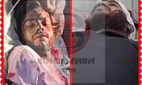 होटल पर खाना खाने के दौरान बोलचाल में चली तलवार, दो युवक घायल, हमलावर फरार