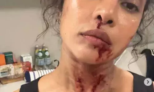 द ब्लफ की शूटिंग के दौरान प्रि‍यंका चौपड़ा हुईं घायल, खून से लथपथ नजर आई एक्ट्रेस