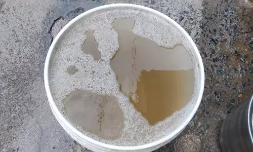 नलों से घरों में पहुंच रहा है गंदा पानी, जलजनित बीमारियों की आशंका, कल्कीपुरा के बाशिंदों में रोष