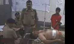 दारोगा के पेट को चीरकर निकली गोली, हेड कांस्टेबल की नाक में घुसी; छह जगह से फट गईं आंतें