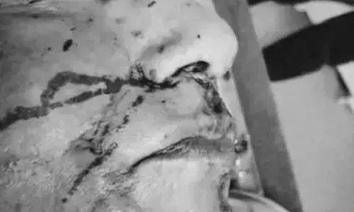 उदयपुर : दुकान के बाहर  तलवार से शिक्षक का कत्ल, बचाने आए पिता का हाथ काटा,प्रदर्शन