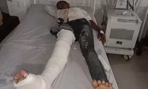 पैर फिसलने से 13 वर्ष का बालक छत से नीचे गिरा पैर फैक्चर