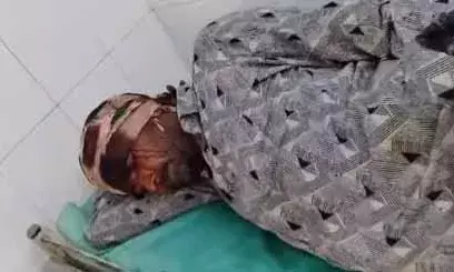 मारपीट कर वृद्ध के गले से सोने की रामनामी व बाइक सवार से छीनी नकदी मारपीट कर वृद्ध के गले से सोने की रामनामी व बाइक सवार से छीनी नकदी