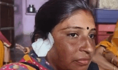 घर में सो रही महिला का कान काट, एक लाख के सोने के झूमके ले गए लुटेरे
