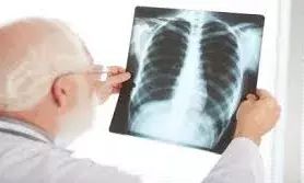 कोविड से ज्यादा खतरनाक बन रही टीबी की बीमारी, हर साल बढ़ रहे इतने केस