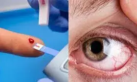बढ़ा हुआ शुगर लेवल बन सकता है अंधेपन का कारण, जानें डायबिटिक रेटिनोपैथी क्या है