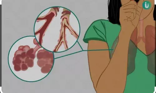 सीओपीडी : बीमारी के लक्षण, कारण और बचाव के तरीके