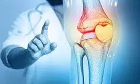 40 की उम्र के बाद हड्डियां होने लगती हैं कमजोर, डॉक्टर से जानें देखभाल के तरीके