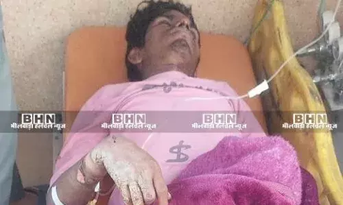 बिजली ग्रिड पर करंट लगने से युवक झुलसा