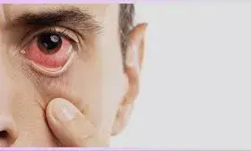 आंखों की वो जानलेवा बीमारी जिसमें आठ दिन में हो जाती है मरीज की मौत आंखों की वो जानलेवा बीमारी जिसमें आठ दिन में हो जाती है मरीज की मौत