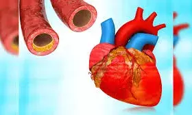 हार्ट में ब्लॉकेज की सही जानकारी देता है ये टेस्ट, दिखे ये लक्षण तो कराएं जांच