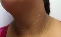 काली गर्दन को साफ और चमकदार बनाने के असरदार घरेलु नुस्खे