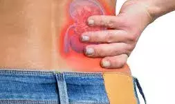 कमर में या पेट के पास, कहां होता है किडनी की पथरी का दर्द, जानें यहां कमर में या पेट के पास, कहां होता है किडनी की पथरी का दर्द, जानें यहां