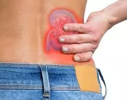 कमर में या पेट के पास, कहां होता है किडनी की पथरी का दर्द, जानें यहां