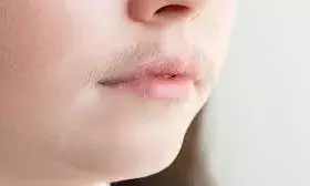 चेहरे के अनचाहे बाल हटाएं, घरेलू उपायों से पाएं चमकती त्वचा और दोगुनी खूबसूरती चेहरे के अनचाहे बाल हटाएं, घरेलू उपायों से पाएं चमकती त्वचा और दोगुनी खूबसूरती