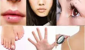 अगर आपकी बॉडी में इन जगहों पर हैं तिल, तो जल्द चमकेगा किस्मत का सितारा