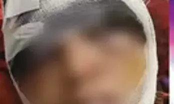 अफेयर के शक में   पत्नी की आंखों की पलक काटी, प्राइवेट पार्ट-शरीर पर किए चाकू से कई वार