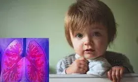 5 साल से कम उम्र के बच्चों पर नहीं हो रहा टीबी की दवाओं का असर, ये है कारण