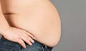 महामारी बनता जा रहा है मोटापा, इससे सतर्क रहना है जरूरी