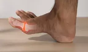 यूरिक एसिड बढ़ने से हैं परेशान, इन फूड आइटम का सेवन है फायदेमंद