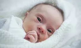 क्या है पियरे रॉबिन सिंड्रोम? बच्चों के जबड़े विकसित नहीं होते, कलावती सरन अस्पताल में इतनों की हुई सर्जरी