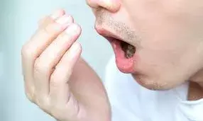 मुंह से आती है गंदी बदबू? लूस होता है कंफिडेंस, फॉलो कर लें ये 5 टिप्स