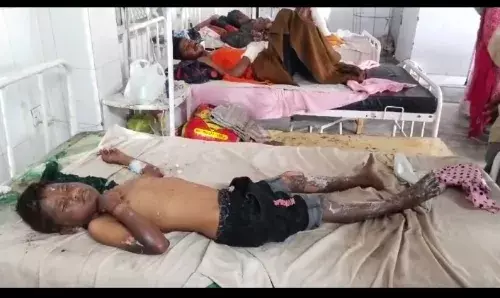 गैस पर खाना बनाते लगी आग  से मां ओर दो बेटे झुलसे , हालत गंभीर