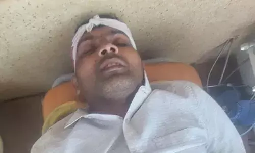 सड़क दुर्घटना में मोटरसाइकिल सवार गंभीर घायल