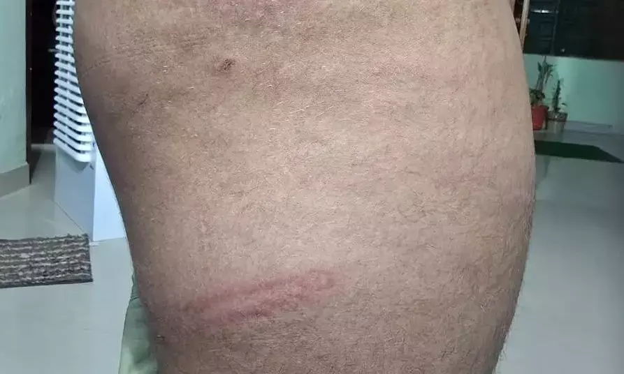 कच्चे आम तोड़ने पर टीचर ने बच्चे को पीटा, डर के मारे कर दी शौच कच्चे आम तोड़ने पर टीचर ने बच्चे को पीटा, डर के मारे कर दी शौच