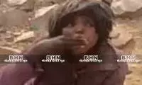 मजबूरी तीन माह से भूख प्यास से तड़प रहीं माया को छोड़ गया राम देखभाल करने वाला कोई नहीं