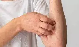 डायबिटीज होने पर स्किन में क्या लक्षण दिखाई देते हैं, जाने कैसे करे बचाव