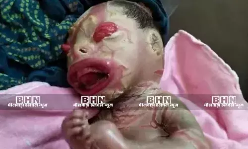 असामान्य मुंह की बनावट वाले बच्चे के जन्म से मचा हड़कंप