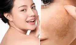 दादी मां के 5 नुस्खे, स्किन चमकाने से लेकर बालों तक के लिए हैं बहुत फायदेमंद