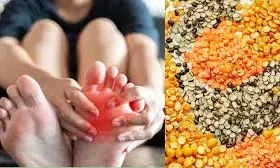 अरहर की दाल, राजमा और फूलगोभी समेत इन चीजें से बना लें दूरी, बढ़े हुए यूरिक एसिड के मरीजों के लिए विशेषज्ञों की सलाह