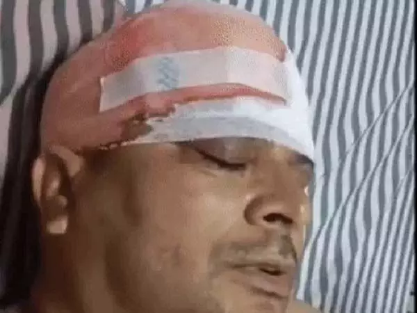 सरपंच पर जानलेवा हमला : अतिक्रमण हटाने पहुंचे थे, लाठी-डंडों से पीटकर तोड़े हाथ-पैर सरपंच पर जानलेवा हमला : अतिक्रमण हटाने पहुंचे थे, लाठी-डंडों से पीटकर तोड़े हाथ-पैर