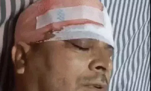 सरपंच पर जानलेवा हमला : अतिक्रमण हटाने पहुंचे थे, लाठी-डंडों से पीटकर तोड़े हाथ-पैर