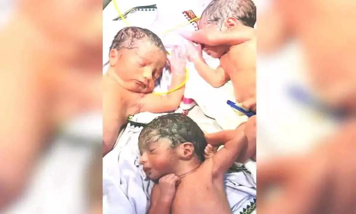 महिला ने एक साथ दिया 3 बच्चों को जन्म