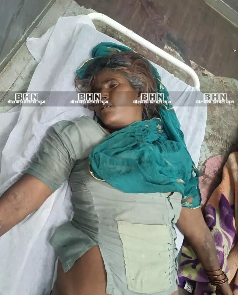 जहरीले जीव के काटने से महिला की मौत जहरीले जीव के काटने से महिला की मौत