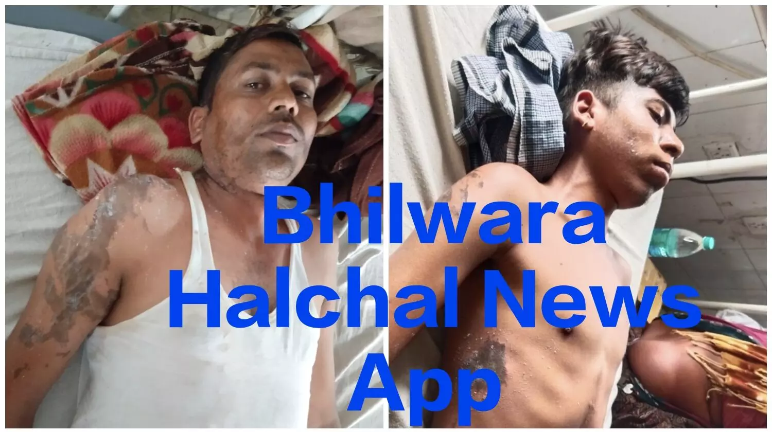 शॉप से घर लौट रहे पिता-पुत्र पर एसिड अटैक, दोनों झुलसे, बाइक सवार दो बदमाशों ने दिया वारदात को अंजाम शॉप से घर लौट रहे पिता-पुत्र पर एसिड अटैक, दोनों झुलसे, बाइक सवार दो बदमाशों ने दिया वारदात को अंजाम