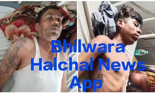 शॉप से घर लौट रहे पिता-पुत्र पर एसिड अटैक, दोनों झुलसे, बाइक सवार दो बदमाशों ने दिया वारदात को अंजाम