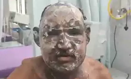 ससुर ने मांगी रोटी, बहू ने पेट्रोल डालकर लगा दी आग