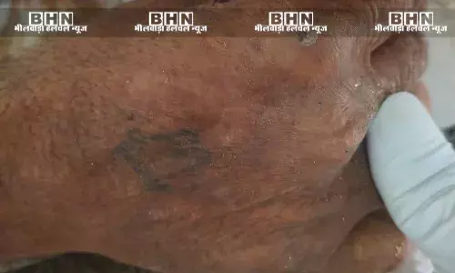 मेजा-बागौर रोड पर प्रौढ़ की खूनसनी लाश मिली, फैली सनसनी