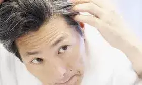 कम उम्र में सफेद हो रहे हैं बाल? जानें एक्सपर्ट से  इसके पीछे की साइंस