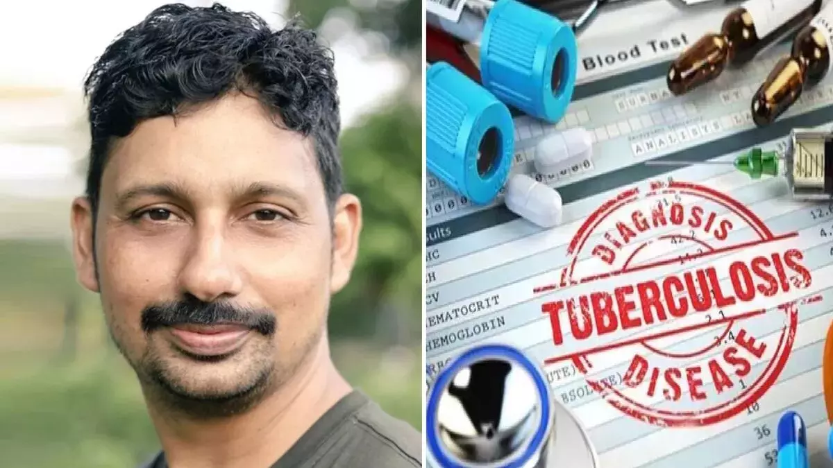 ना शर्माना, ना घबराना, टीबी की जांच करवाना ना शर्माना, ना घबराना, टीबी की जांच करवाना