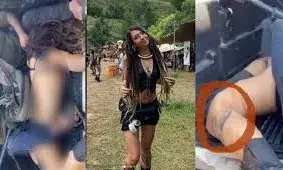 महिलाओं को नंगा कर पेड़ों से बांध प्राइवेट पार्ट्स में मारी गोली, लाशों से किया रेप!