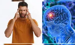 ब्रेन स्ट्रोक आने से पहले शरीर में दिखते हैं ये 6 संकेत