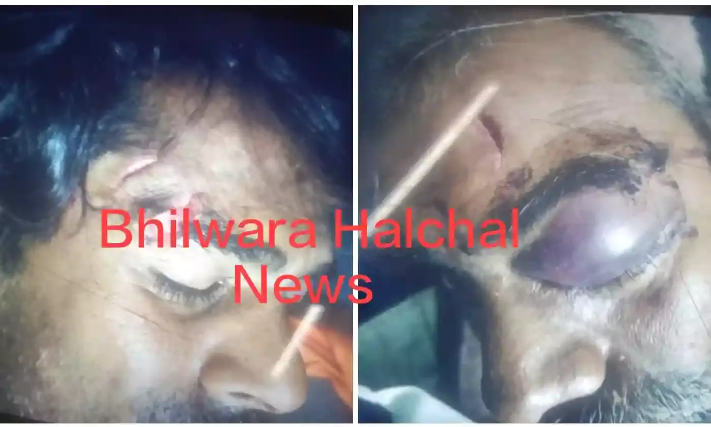 सुरास में आधी रात को मकान का दरवाजा तोडक़र घुसे लोग, दो ममेरे भाइयों पर हमला कर नकदी व महिलाओं से गहने लूटे