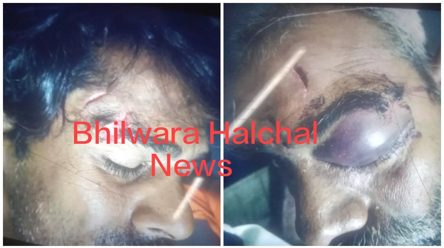 सुरास में आधी रात को मकान का दरवाजा तोडक़र घुसे लोग, दो ममेरे भाइयों पर हमला कर नकदी व महिलाओं से गहने लूटे सुरास में आधी रात को मकान का दरवाजा तोडक़र घुसे लोग, दो ममेरे भाइयों पर हमला कर नकदी व महिलाओं से गहने लूटे