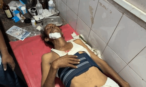 मिनी बस ट्रेलर से भिड़ी,एक की मौत,आधा दर्जन से ज्यादा श्रद्धालु घायल,सांवलिया जी से लौटते समय हुआ हादसा