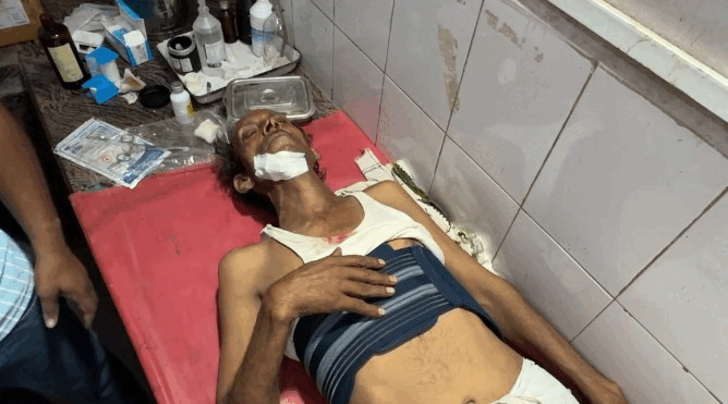 मिनी बस ट्रेलर से भिड़ी,एक की मौत,आधा दर्जन से ज्यादा श्रद्धालु घायल,सांवलिया जी से लौटते समय हुआ हादसा